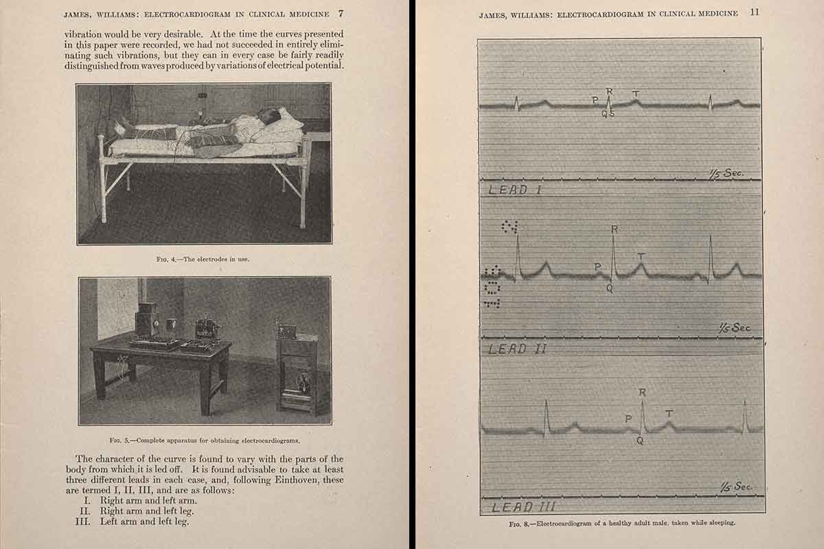 12-a-b-electrocardiogram.jpg