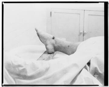 A1.1 Personal Injury-Accident