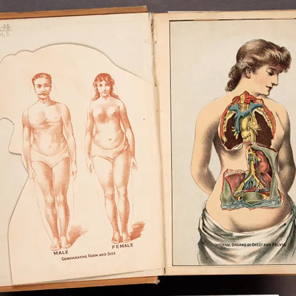 19th century medical illustration of woman