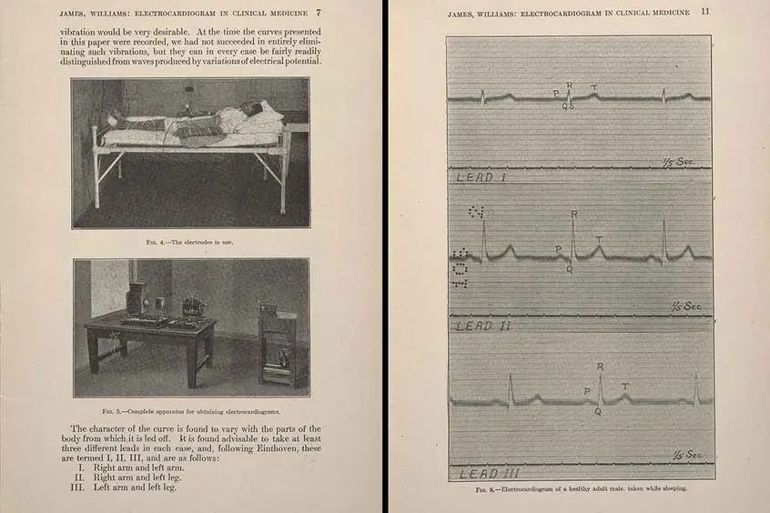 12-a-b-electrocardiogram.jpg