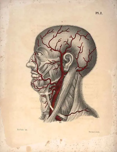Paul Goddard, Plates of the Arteries