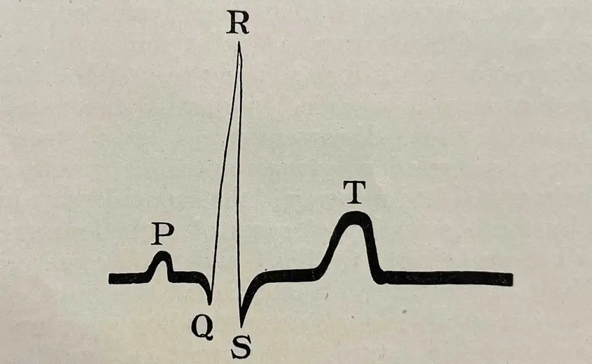 The Electrocardiogram in Clinical Medicine