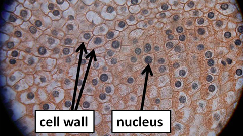 Onion root tip detail Onion root tip detail