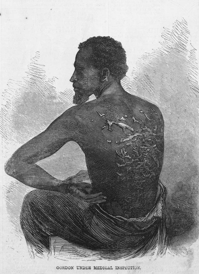 A 1863 image of a slave with scars on his back 